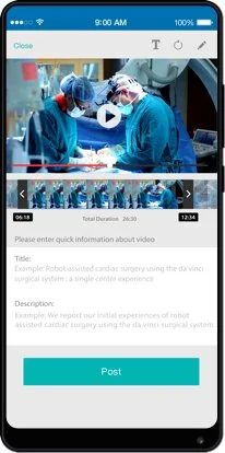 Scalpel mobile four
